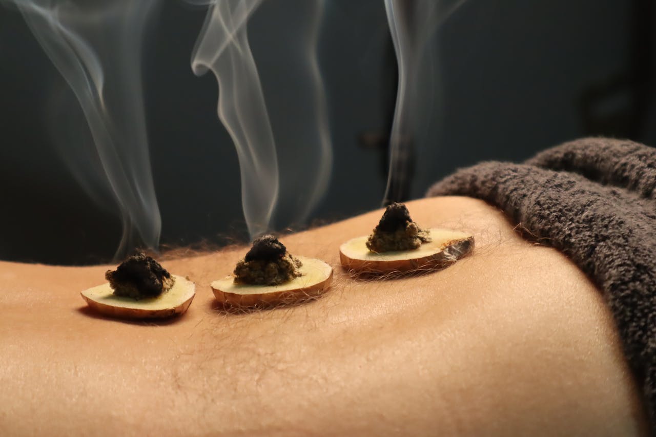 Julie Molines NATUROPATHE à REYNIèS 82 Close-up of traditional moxibustion therapy with smoke rising from moxa cones.